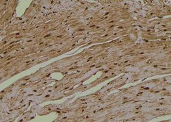 Invitrogen Phospho-Amyloid Precursor Protein (Tyr757) Polyclonal Antibody 100 &mu;L | Buy Online | Invitrogen&trade; | Fisher Scientific