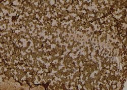 Invitrogen Phospho-EIF2S1 (Tyr150) Polyclonal Antibody 100 &mu;L; Unconjugated:Antibodies,