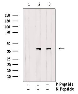 Invitrogen Phospho-EIF2S1 (Tyr150) Polyclonal Antibody 100 &mu;L; Unconjugated:Antibodies,