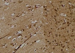 Invitrogen Phospho-ITGB1 (Tyr795) Polyclonal Antibody 100 μL; Unconjugated:Antibodies,