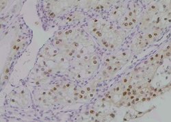 Invitrogen Phospho-PKC beta-1 (Thr642, Thr644) Polyclonal Antibody 100