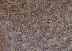 Invitrogen Phospho-PKC beta-1 (Thr642, Thr644) Polyclonal Antibody 100