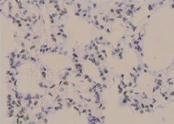 Invitrogen Phospho-PKC beta-1 (Thr642, Thr644) Polyclonal Antibody 100