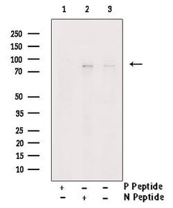 Invitrogen Phospho-PKC beta-1 (Thr642, Thr644) Polyclonal Antibody 100