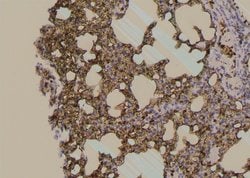 Invitrogen Phospho-LCK (Tyr394) Polyclonal Antibody 100 &mu;L; Unconjugated:Antibodies,