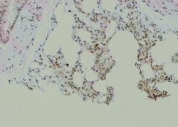 Invitrogen Phospho-LCK (Tyr394) Polyclonal Antibody 100 &mu;L; Unconjugated:Antibodies,
