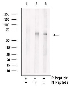 Invitrogen Phospho-LCK (Tyr394) Polyclonal Antibody 100 &mu;L; Unconjugated:Antibodies,