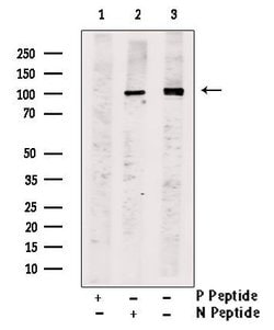Invitrogen Phospho-Progesterone Receptor (Ser79, Ser81) Polyclonal Antibody 100 &mu;L | Buy Online | Invitrogen&trade; | Fisher Scientific