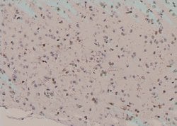 Invitrogen Phospho-HSP90 alpha (Tyr197) Polyclonal Antibody 100 μL;