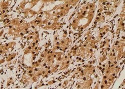 Phospho-IGF1R (CD221) (Thr1163) Polyclonal Antibody 100 &mu;L | Buy Online | Thermo Scientific | Fisher Scientific