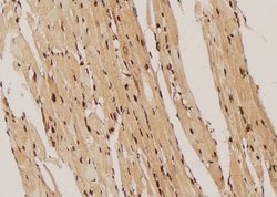 Phospho-IGF1R (CD221) (Thr1163) Polyclonal Antibody 100 &mu;L | Buy Online | Thermo Scientific | Fisher Scientific