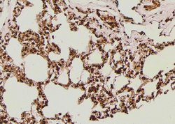 Phospho-IGF1R (CD221) (Thr1163) Polyclonal Antibody 100 &mu;L | Buy Online | Thermo Scientific | Fisher Scientific