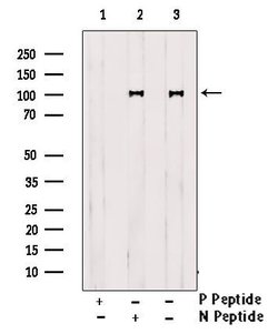 Phospho-IGF1R (CD221) (Thr1163) Polyclonal Antibody 100 &mu;L | Buy Online | Thermo Scientific | Fisher Scientific