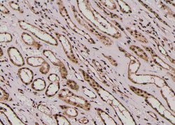 Invitrogen Phospho-E-cadherin (Tyr754) Polyclonal Antibody 100 &mu;L; Unconjugated:Antibodies,