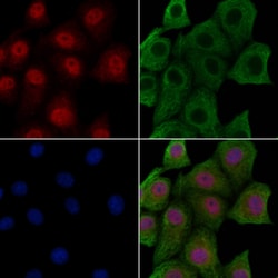 Invitrogen Phospho-EEF2 (Tyr443) Polyclonal Antibody 100 μL; Unconjugated:Antibodies,