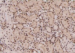 Invitrogen Phospho-EEF2 (Tyr443) Polyclonal Antibody 100 μL; Unconjugated:Antibodies,