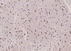 Invitrogen Phospho-EEF2 (Tyr443) Polyclonal Antibody 100 μL; Unconjugated:Antibodies,