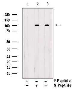 Invitrogen Phospho-EEF2 (Tyr443) Polyclonal Antibody 100 μL; Unconjugated:Antibodies,