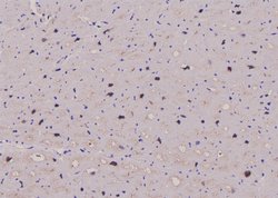 Invitrogen Phospho-EEF2 (Thr57) Polyclonal Antibody 100 &mu;L | Buy Online | Invitrogen&trade; | Fisher Scientific
