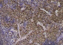 Invitrogen Phospho-EEF2 (Thr57) Polyclonal Antibody 100 &mu;L | Buy Online | Invitrogen&trade; | Fisher Scientific