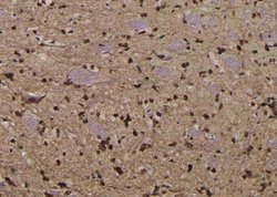 Invitrogen Phospho-EEF2 (Thr57) Polyclonal Antibody 100 &mu;L | Buy Online | Invitrogen&trade; | Fisher Scientific