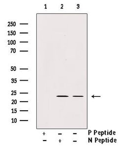 Invitrogen Phospho-TPT1 (Ser53) Polyclonal Antibody 100 &mu;L; Unconjugated:Antibodies,