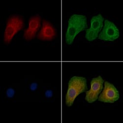 Invitrogen Phospho-L-Plastin (Tyr300) Polyclonal Antibody 100 &mu;L; Unconjugated:Antibodies,