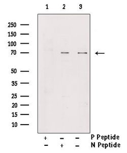 Invitrogen Phospho-L-Plastin (Tyr300) Polyclonal Antibody 100 &mu;L; Unconjugated:Antibodies,
