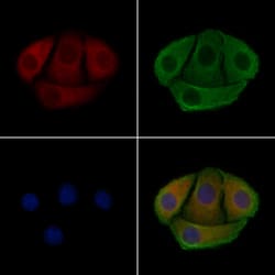 Invitrogen Phospho-p47phox (Ser304) Polyclonal Antibody 100 μL; Unconjugated:Antibodies,