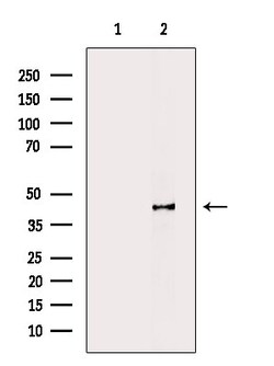 Invitrogen Phospho-p47phox (Ser304) Polyclonal Antibody 100 μL; Unconjugated:Antibodies,