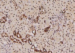 Invitrogen Phospho-p47phox (Ser304) Polyclonal Antibody 100 μL; Unconjugated:Antibodies,
