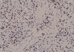 Invitrogen Phospho-PKM2 (Tyr83) Polyclonal Antibody 100 &mu;L; Unconjugated:Antibodies,