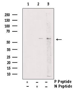 Invitrogen Phospho-PKM2 (Tyr83) Polyclonal Antibody 100 &mu;L; Unconjugated:Antibodies,