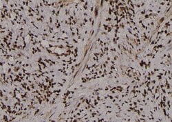 Invitrogen Phospho-PKM2 (Tyr370) Polyclonal Antibody 100 μL; Unconjugated:Antibodies,