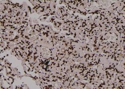 Invitrogen Phospho-PKM2 (Tyr370) Polyclonal Antibody 100 μL; Unconjugated:Antibodies,