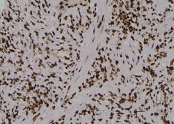 Invitrogen Phospho-PKM2 (Ser148) Polyclonal Antibody 100 &mu;L; Unconjugated:Antibodies,