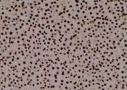Invitrogen Phospho-PKM2 (Ser148) Polyclonal Antibody 100 &mu;L; Unconjugated:Antibodies,