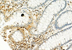 Invitrogen Phospho-PKM2 (Ser37) Polyclonal Antibody 100 &mu;L; Unconjugated:Antibodies,