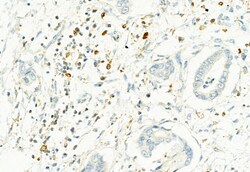 Invitrogen Phospho-PKM2 (Ser37) Polyclonal Antibody 100 &mu;L; Unconjugated:Antibodies,