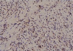 Invitrogen Phospho-PKM2 (Ser37) Polyclonal Antibody 100 &mu;L; Unconjugated:Antibodies,