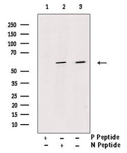 Invitrogen Phospho-PKM2 (Ser37) Polyclonal Antibody 100 &mu;L; Unconjugated:Antibodies,