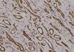 Invitrogen Phospho-MYOD (Thr115) Polyclonal Antibody 100 &mu;L | Buy Online | Invitrogen&trade; | Fisher Scientific