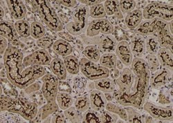 Invitrogen Phospho-MYOD (Thr115) Polyclonal Antibody 100 &mu;L | Buy Online | Invitrogen&trade; | Fisher Scientific