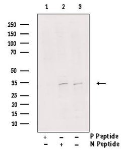 Invitrogen Phospho-MYOD (Thr115) Polyclonal Antibody 100 &mu;L | Buy Online | Invitrogen&trade; | Fisher Scientific