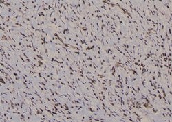 Invitrogen Phospho-IFNGR1 (Tyr457) Polyclonal Antibody 100 &mu;L; Unconjugated:Antibodies,