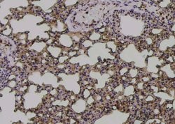 Invitrogen Phospho-IFNGR1 (Tyr457) Polyclonal Antibody 100 &mu;L; Unconjugated:Antibodies,