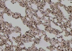 Invitrogen Phospho-IFNGR1 (Tyr457) Polyclonal Antibody 100 &mu;L; Unconjugated:Antibodies,