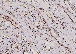 Invitrogen Phospho-Fra1 (Thr227) Polyclonal Antibody 100 &mu;L; Unconjugated:Antibodies,