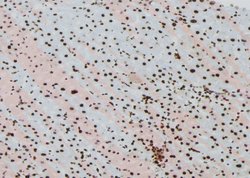 Invitrogen Phospho-Fra1 (Thr227) Polyclonal Antibody 100 &mu;L; Unconjugated:Antibodies,