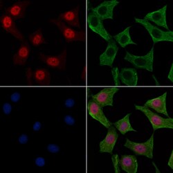 Invitrogen Phospho-FER (Tyr497) Polyclonal Antibody 100 &mu;L; Unconjugated:Antibodies,